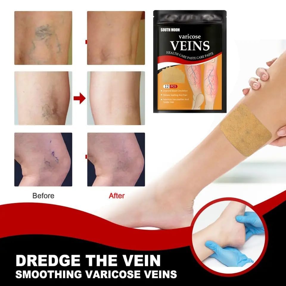 Varicose Veins Patches Dredge Vein Smoothing Varicose Veins Reduce Swelling Relieve Pain - Image 10